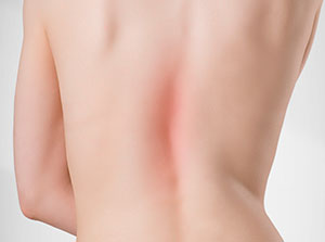 Shoulder and upper back pain testimonials