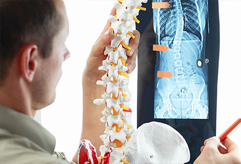 Chiropractic biophysics for spinal correction