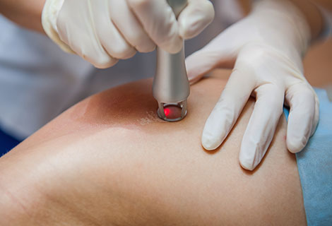 Class IV laser therapy for pain relief