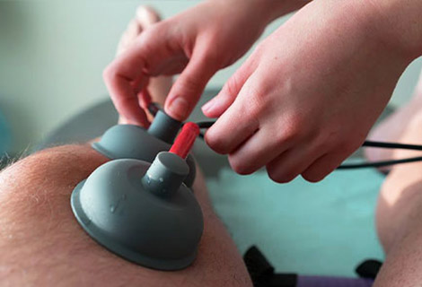 Electroanalgesic Therapy for neuropathy relief